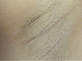 300人の腋 2　サンプル画像09